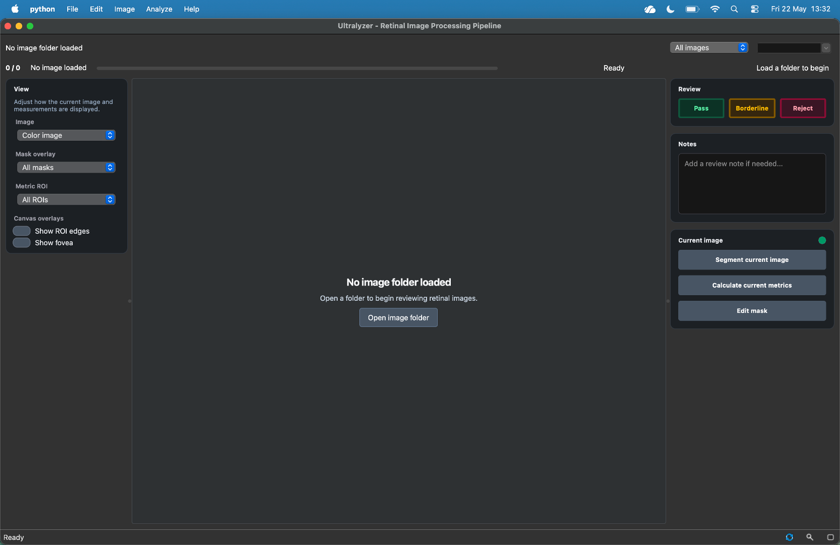 Ultralyzer main window overview